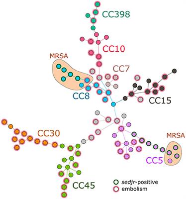 Staphylococcus aureus CC30 Lineage and Absence of sed,j,r-Harboring Plasmid Predict Embolism in Infective Endocarditis